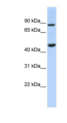 Polyclonal Rabbit anti-Human PME-1 / PPME1 Antibody (aa35-84, IHC, WB)