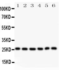 LGALS3 / Galectin 3 Antibody (aa139-250)