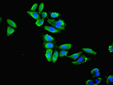 Polyclonal Rabbit anti-Human ENO1 / Alpha Enolase Antibody (IHC, WB)