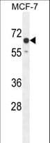 C15orf27 Antibody (aa503-531)