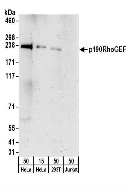 IHC-plus™ Polyclonal Rabbit anti-Human ARHGEF28 Antibody (aa1655-1705, IHC, WB)