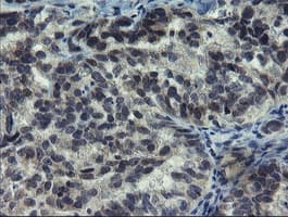 Monoclonal Mouse anti-Human NUB1 Antibody (clone OTI2G1, IHC, WB)