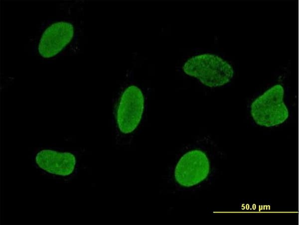 IHC-plus™ RSL24D1 Antibody (clone 2A10-1E5)