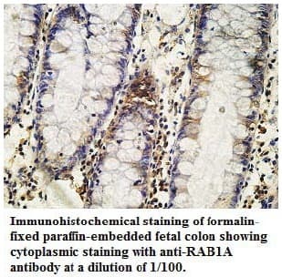 RAB1A Antibody (aa1-204)