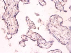 PKMYT1 Antibody