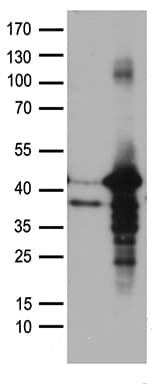 Polyclonal Rabbit anti-Human NHEJ1 / XLF Antibody (WB)