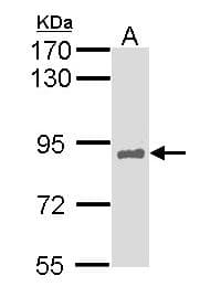 Polyclonal Rabbit anti-Human HNF1A / HNF1 Antibody (aa35-268, IHC, WB)