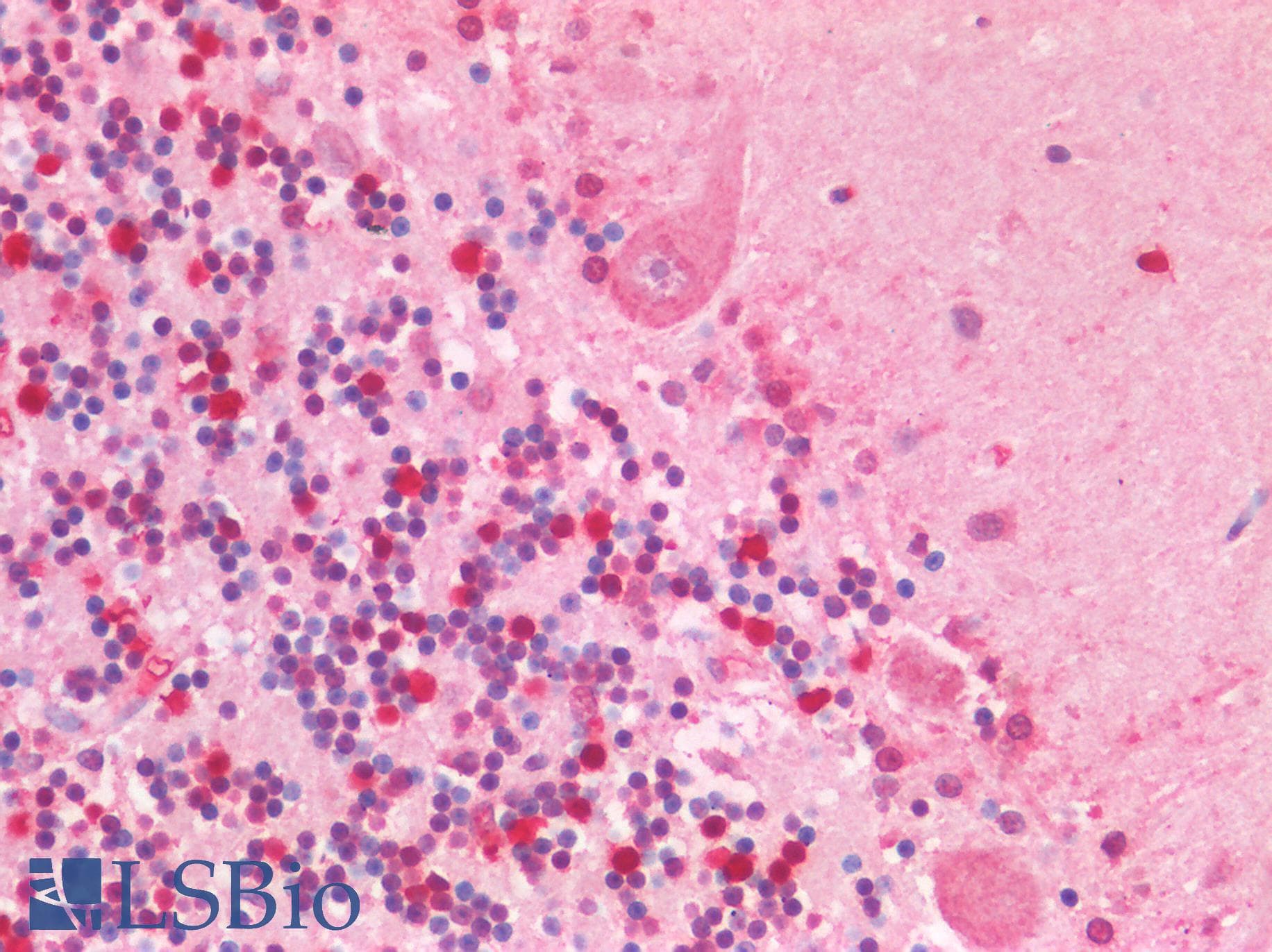PathPlus™ Polyclonal Rabbit anti-Human SMC1A / SMC1 Antibody (IHC, IF, WB)
