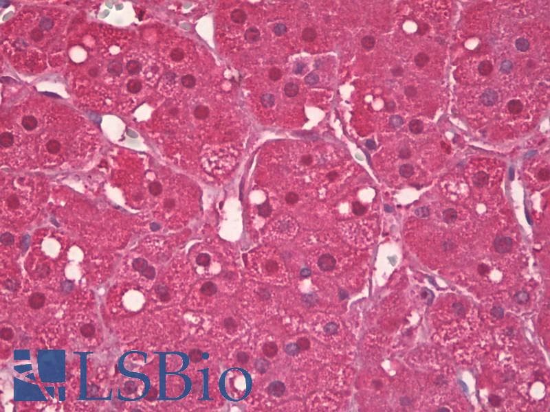 IHC-plus™ Polyclonal Rabbit anti-Human SNCG / Gamma-Synuclein Antibody (aa78-127, IHC, WB)
