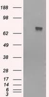 BTK Antibody (clone OTI1H7)
