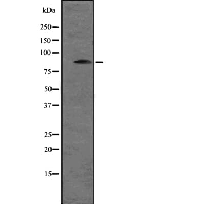 Polyclonal Rabbit anti-Human SNRK Antibody (WB)