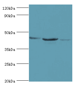 Polyclonal Rabbit anti-Human ACAT1 Antibody (aa1-145, IHC, WB)