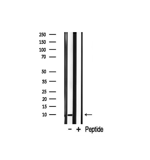 Polyclonal Rabbit anti-Human S100A1 / S100-A1 Antibody (IHC, IF, WB)