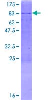 Human PPM1J Protein (Recombinant GST)