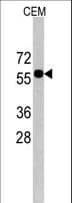 CNOT4 / CLONE243 Antibody (aa378-407)