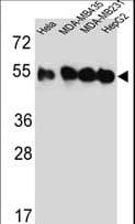 Polyclonal Rabbit anti-Human TUBB4B / Tubulin Beta 4B Antibody (aa99-125, IHC, WB)