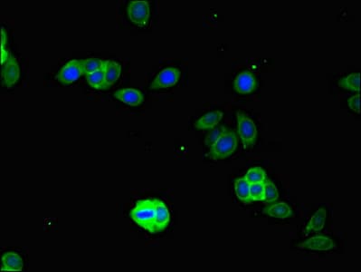 Polyclonal Rabbit anti-Human IFIH1 / MDA5 Antibody