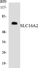 IHC-plus™ Polyclonal Rabbit anti-Human SLC16A2 / MCT8 Antibody (aa93-142, IHC, WB)