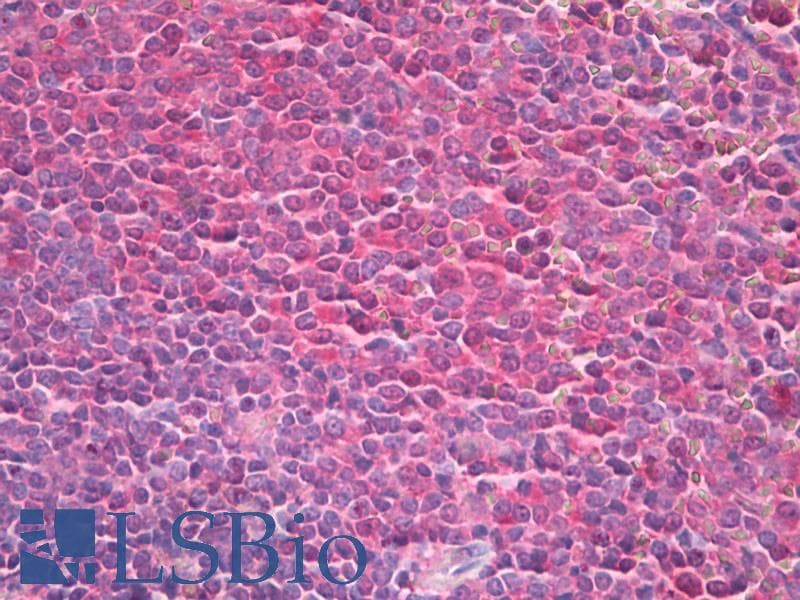 IHC-plus™ Monoclonal Mouse anti-Human TPT1 / TCTP Antibody (clone 18, IHC, WB)