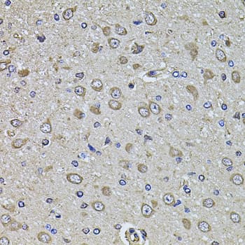 EPHA3 / EPH Receptor A3 Antibody
