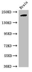 RBBP6 Antibody (aa51-97)