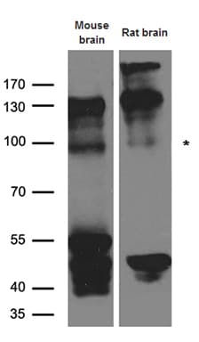 Polyclonal Rabbit anti-Human EPHA4 / EPH Receptor A4 Antibody (WB)