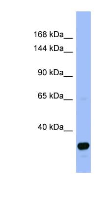 FANCA Antibody (aa71-120)