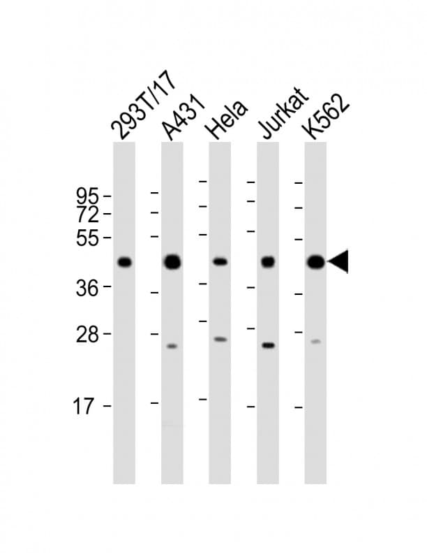 Polyclonal Rabbit anti-Human PHF6 Antibody (aa315-349, WB)