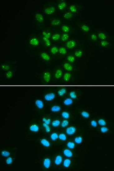 BMI1 / PCGF4 Antibody