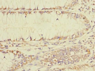 Polyclonal Rabbit anti-Human BEX1 Antibody