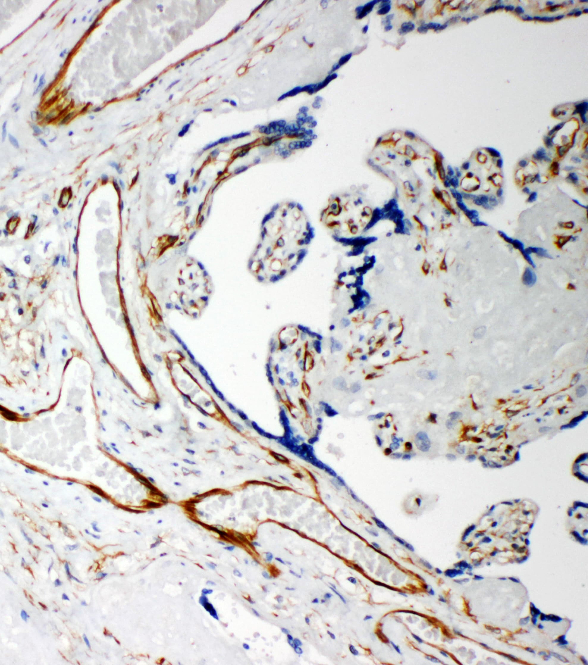 Polyclonal Rabbit anti-Human IDS / Iduronate 2 Sulfatase Antibody (aa430-448, IHC, WB)