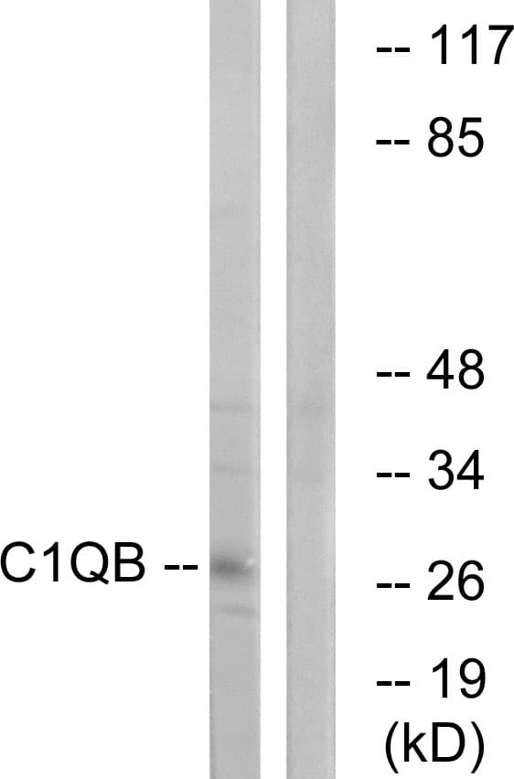Polyclonal Rabbit anti-Human Complement C1QB Antibody (aa161-210, IF, WB)