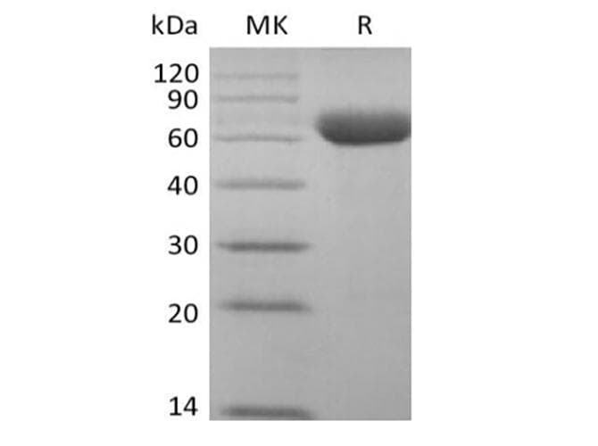 Cynomolgus SIGLEC15 Protein (Recombinant Fc, C-terminus)