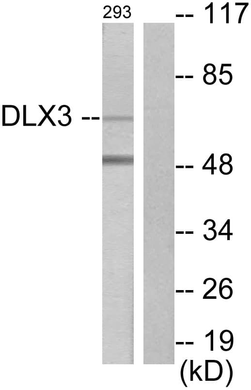 Polyclonal Rabbit anti-Human DLX3 Antibody (aa71-120, IHC, WB)