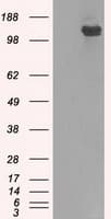 BUB1B / BubR1 Antibody (clone OTI3C7)
