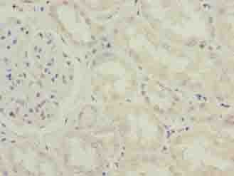 Polyclonal Rabbit anti-Human IFI44 Antibody (IHC, WB)