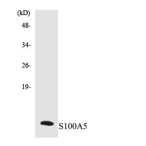 S100A5 Antibody (aa21-70)