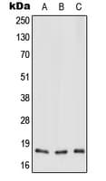 Polyclonal Rabbit anti-Human MT-ND3 Antibody (N-Terminus, WB)