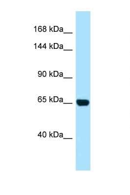 PALB2 Antibody (aa677-726)