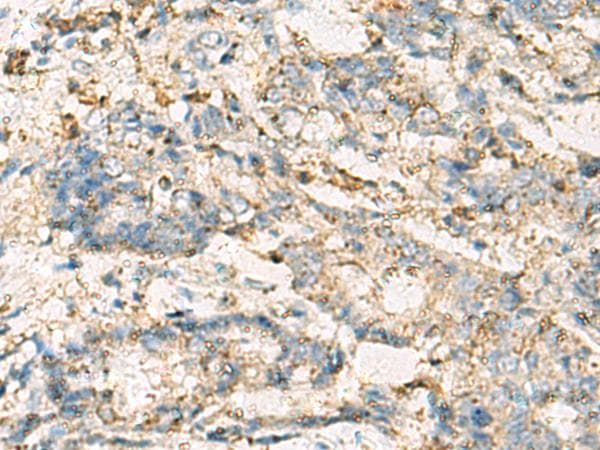 VTA1 Antibody