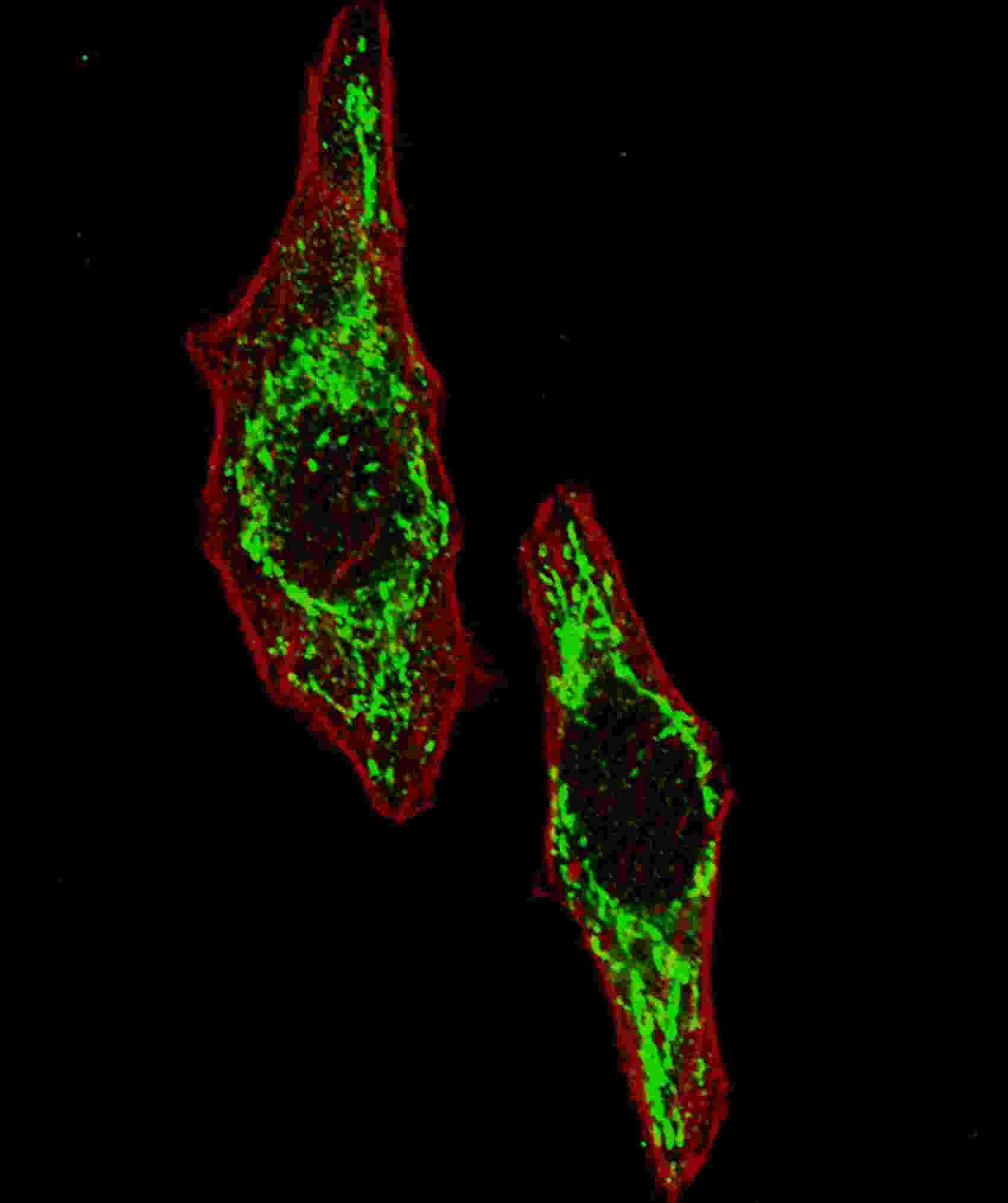 HSPD1 / HSP60 Antibody (aa187-215)