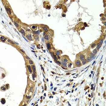 Polyclonal Rabbit anti-Human CTSS / Cathepsin S Antibody (IHC, WB)