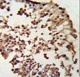 RB1 / Retinoblastoma / RB Antibody (aa858-886)