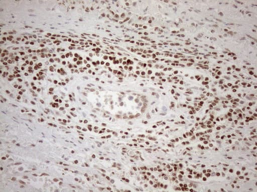 MGMT Antibody (clone OTI4F9)