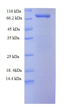 Human STI1 / STIP1 Protein (Recombinant His-SUMO)