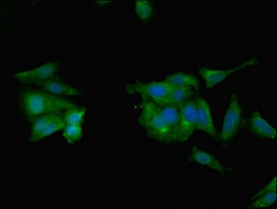 IHC-plus™ Polyclonal Rabbit anti-Human CCL2 / MCP1 Antibody (IHC)
