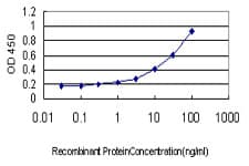 NR1H2 / LXR Beta Antibody (clone 2H2-H3)