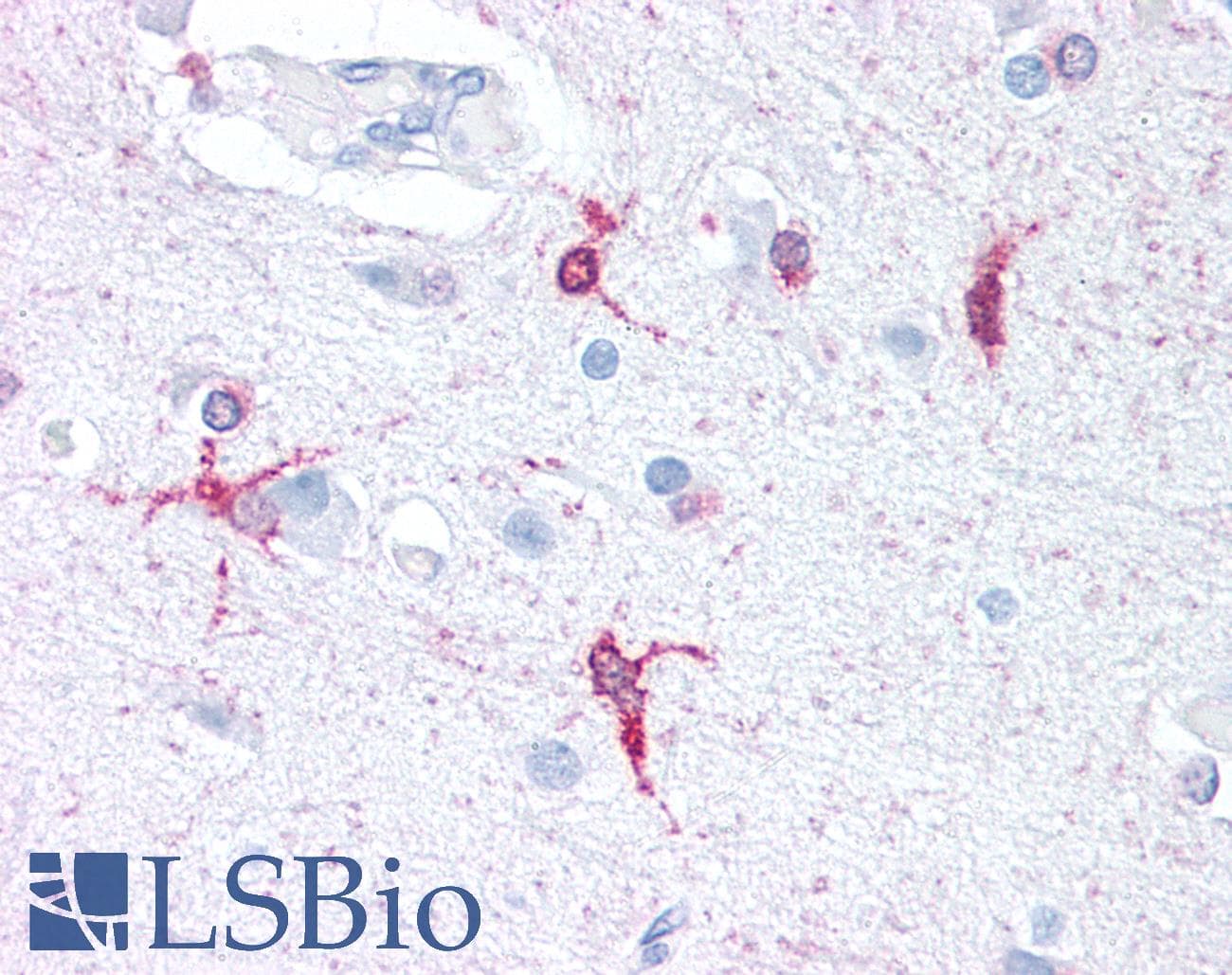 PathPlus™ FSCN1 / Fascin Antibody
