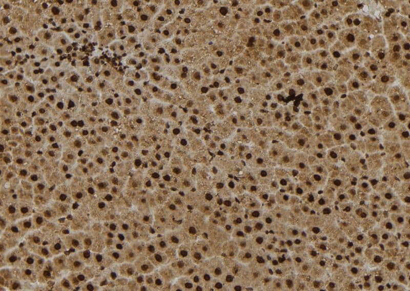 RPS27 / Ribosomal Protein S27 Antibody