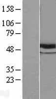 TUBB / Beta Tubulin Protein (Over-Expression Lysate Myc-DDK (Flag))